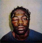 rodney king after police beating 144x150 Rodney King dead at 47