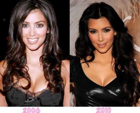 kim kardashian plastic surgery 2006 Kim Kardashian a changing, jealous of everyone!