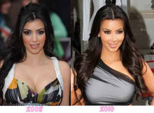kim kardashian plastic surgery Kim Kardashian a changing, jealous of everyone!