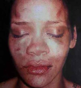 rihanna beating chris brown 276x300 Rihanna loves Chris Brown
